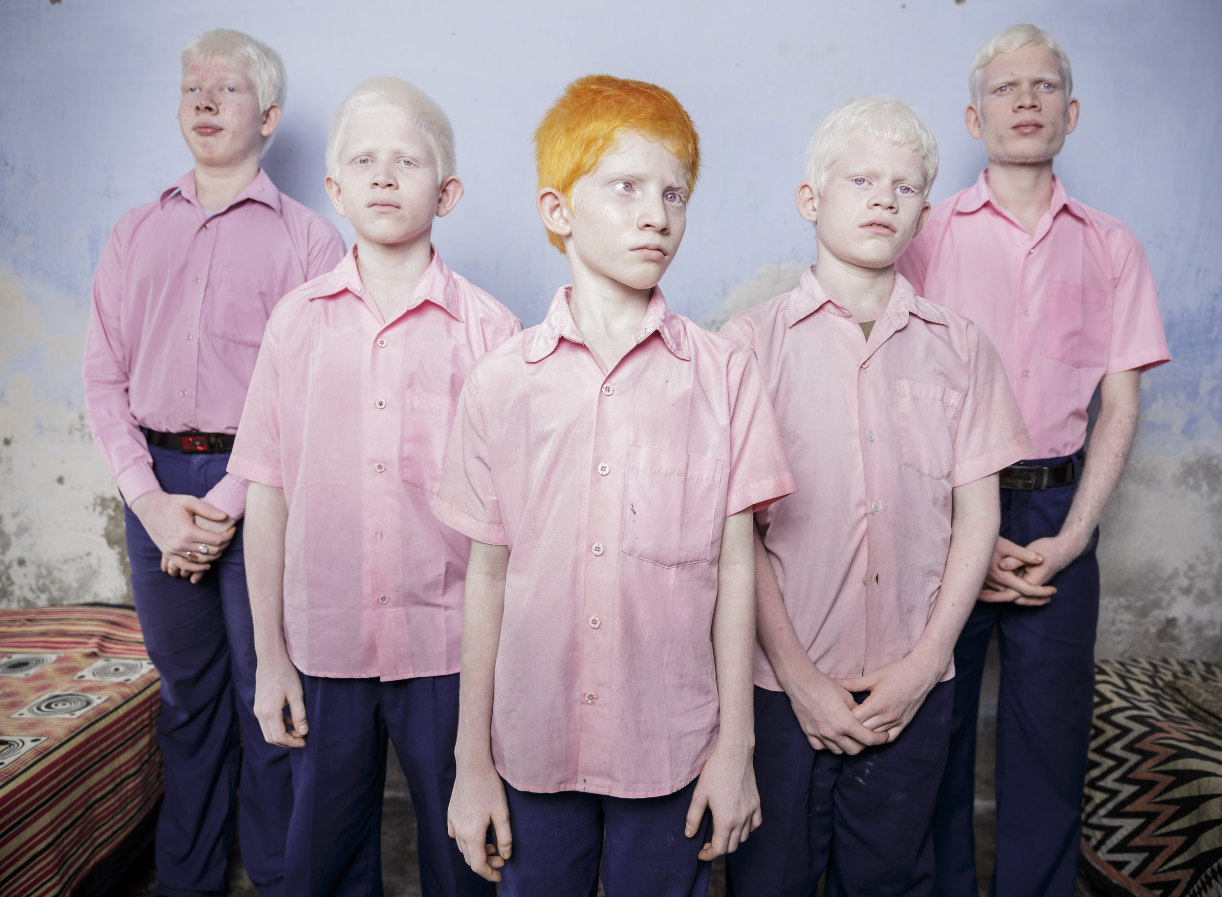 Albinism Not A Curse WarPaint Journal