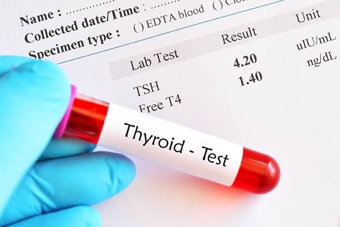 hypothyroidism and blood tests