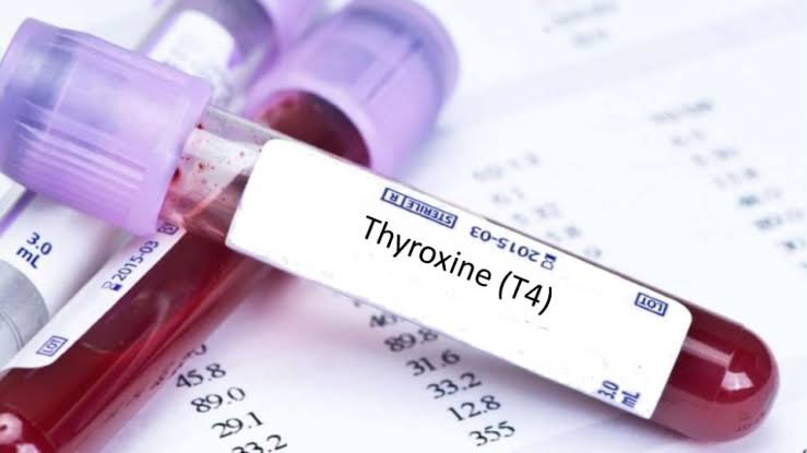 thyroxine t4 blood test